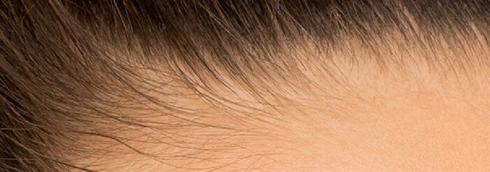 Hair Scalps